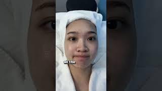 This Painless Acne Facial is a MustTry [upl. by Vernen825]