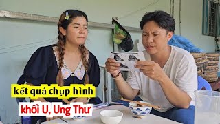 Sự Thật Về Khối U Trong Ổ Bụng Của Vợ Thái Có Phải Là Ung Thư   DuyNisa [upl. by Ssitnerp]