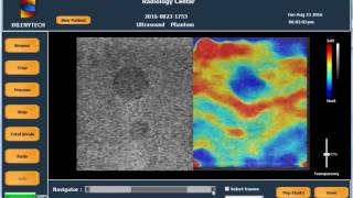 Strain Elastography using USElasto V10 Phantom Exp 3 [upl. by Elkcim]