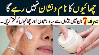 صرف 7 دنوں میں جھائیوں سے نجات پائیں I Reduce Melasma I Pigmentation I Discolouration I Blackspots [upl. by Morey]