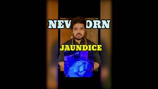 JAUNDICE IN NEWBORN BABIES jaundice treatment newborn viral awareness [upl. by Ronda]