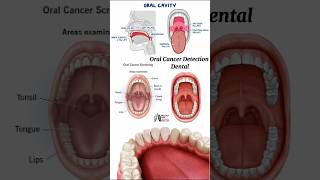 Oral Cancer Detection  Dental medical animation 3d short [upl. by Atinej762]