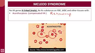 Hematology  4  U1L48  Kell blood group system [upl. by Repsihw]