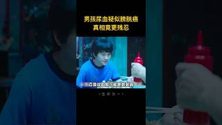 男孩尿血疑似膀胱癌，誰想真相竟更殘忍，男孩父母根本頂不住，結局讓人想不到！ [upl. by Ennayk370]