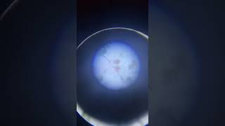 Contaminated water inside microscopesciencemicroscope [upl. by Dall268]