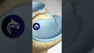 See how a Meniscus Root Repair of the Knee works  3D animation meniscus [upl. by Robi544]