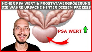 Hoher PSA Wert und PROSTATAVERGRÖßERUNG Prostatakrebs  Was ist die WAHRE Ursache [upl. by Aicerg99]