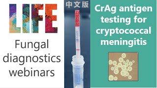 Cryptococcal antigen CrAg testing  webinar and QampA  for fungal meningitis [upl. by Bible424]