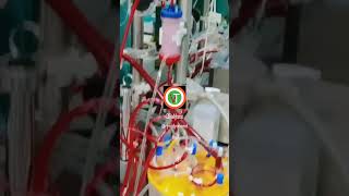 Dialysisprocess of dialysisnursingdoctorBsc Nursing Gnmanmkidney dialysis procedure [upl. by Silliw]