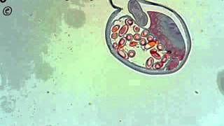 Trichuris trichiura cross section [upl. by Ezechiel]