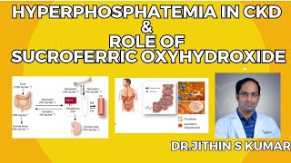 HYPERPHOSPHATEMIA IN CKD amp ROLE OF SUCROFERRIC OXYHYDROXIDE  DRJITHIN S KUMAR [upl. by Omora]