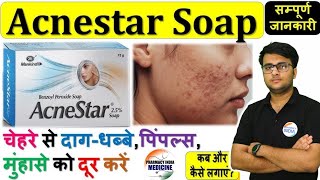 Acnestar Soap की जानकारी  Acnestar Soap for AcnePimples  Benzoyl peroxide acnetreatment acne 🔥 [upl. by Anoiek]