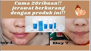 Review Wardah Acnederm Series pemakaian 7 HARI [upl. by Deloria]