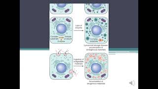 Parenchymal Stromal  Vascular Dystrophiesamp Mixed DystophiesCalcification pathology [upl. by Retla]