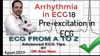 ECG from A to Z intermediate level Arrhythmia 18 Dr Alaa Nasr 2019 [upl. by Ennirok]