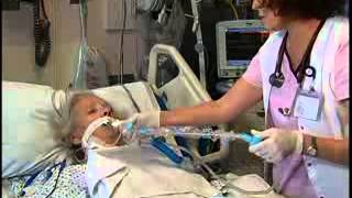 Tracheostomy Suctioning Free Nursing Video Lecture [upl. by Salguod]