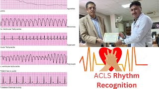 ACLS Precourse SelfAssessment and Precourse Work [upl. by Ennovehc]