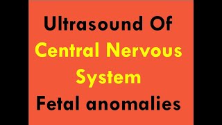 Ultrasound of CNS foetal anomalies [upl. by Airenahs187]