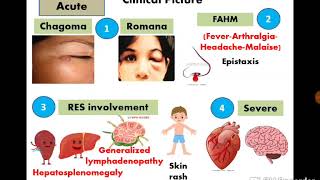 9 American trypanosomiasis  Dr Noha Madbouly [upl. by Halimaj140]