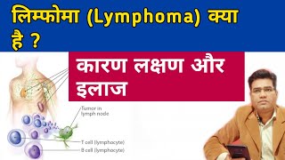 What is Lymphoma  its Cause Symptoms and Treatment [upl. by Asabi]