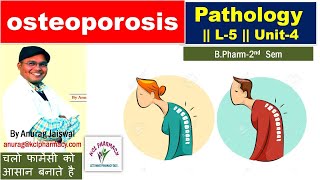 Osteoporosis  Pathology  L5 Unit 4 for BPharm 2nd Sem [upl. by Walt]