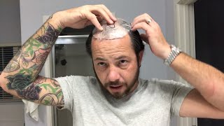 How To Cut Your Hair Where Your Template Goes Using A Hair Replacement Or Hair System [upl. by Atirres]