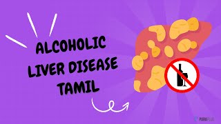 Alcoholic Liver Disease in Tamil Definition Types Symptoms Causes Pathophysiology amp Management [upl. by Teragram]