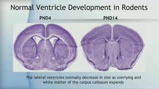 Developmental Neurotoxicity of Ultrafine Particles Parallels with Neurodevelopmental Disorders [upl. by Enak]