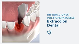 Instrucciones Postoperatorias Extracción Dental  Columbia Basin Oral amp Maxillofacial Surgeons [upl. by Merceer95]