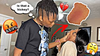 HICKEY PRANK ON BOYFRIEND…HE FLIPPED🤬🤯 [upl. by Rocky96]