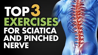 Top 3 Exercises for Sciatica and Pinched Nerve [upl. by Eziechiele]