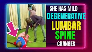 🔴KAKANDE TESTIMONIES  FROM NAMIBIA SHE HAS MILD DEGENERATIVE LUMBAR SPINE CHANGES JC5455 [upl. by Ahsemad]