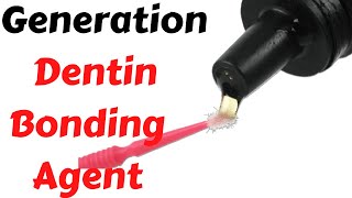 Enamel amp Dentin Bonding Agent Classification Generation  Lecture Adhesion in Dentistry in Hindi [upl. by Nosrettap]