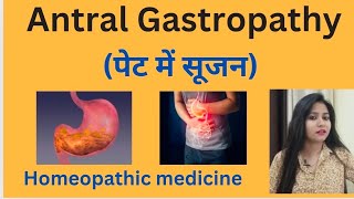 Antral Gastropathy पेट में सूजन treatment  Antral gastritis symptomscause amp homeopathic medicine [upl. by Orimlede]