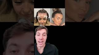 Transform Your Hairline with a Female Hair Transplant [upl. by Olaznog]