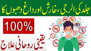 Jild Ki AllergyKharish Aur Daag Dhabe Ka 100 Yaqeeni Rohani Ilaj  Naqsh For Skin Allergy [upl. by Kowalski972]