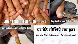 Bitten Nails पर Acrylic Nail Extension कैसे करे  Watch me work on a client with bitten short nails [upl. by Niran]