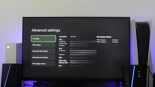 Cant Get Teredo Ip Address Xbox Series XS Fix [upl. by Anig]