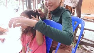 Get Rid of Lice FAST with This Simple Hack 2 [upl. by Solana]