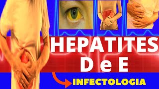 HEPATITE D e E  CARACTERÍSTICAS SINTOMAS DIAGNÓSTICO E TRATAMENTO  INFECTOLOGIA [upl. by Urbannai84]