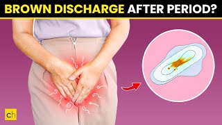 How To Stop Brown Discharge After Period  Causes amp Natural Remedies [upl. by Ahsiyn]