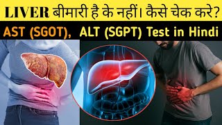 Usir पेट में दर्द पेट खराब होना कौन सा Blood Test कराएं  ALT SHOT और AST SGOT TEST shorts [upl. by Dreher811]