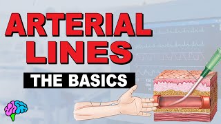 What is an Aline Arterial Line Basics EXPLAINED [upl. by Howund]