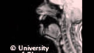 MRI voiceless velar plosive [upl. by Charis]