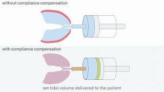 Protective ventilation during pediatric surgery with Atlan anaesthesia workstations [upl. by Marcus]