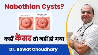 What is Nabothian Cyst  Symptoms of Nabothian Cyst  Homeopathic Treatment of Nabothian Cyst [upl. by Eltsirc]