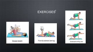 Piriformis syndrome [upl. by Shaffer]