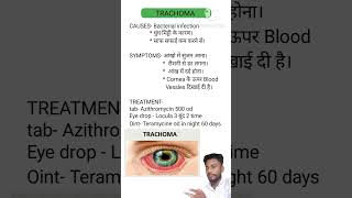 Trachoma treatment [upl. by Harle846]