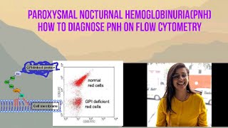 PAROXYSMAL NOCTURNAL HEMOGLOBINURIA [upl. by Jahdal]