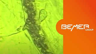 The BEMER Effect  microscopic demonstration of the effect on microcirculation  EN [upl. by Anrapa]